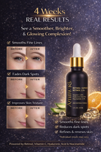 Ammuri Retinol Supreme 2.5% Serum – Anti-Aging Treatment - Age-Defying Formula