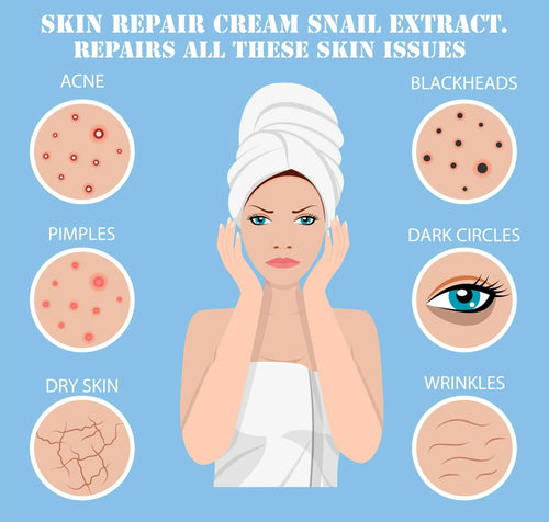 Ammuri Snail Extract Skin Repair Cream